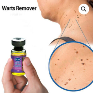 Achill Remover